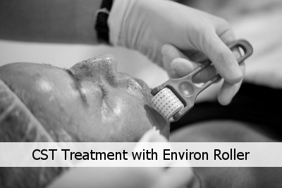 Collagen Stimulation Therapy roller