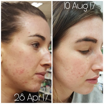 Skin Accumax Environ Jane Iredale Jane Side 1 min