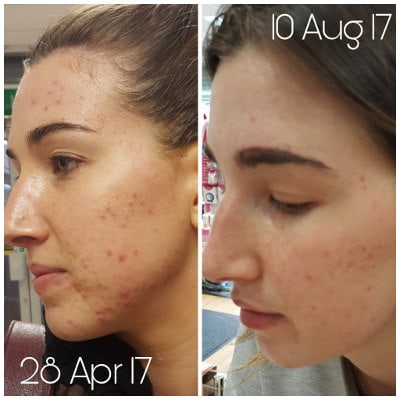 Skin Accumax Environ Jane Iredale Jane Side 2 min