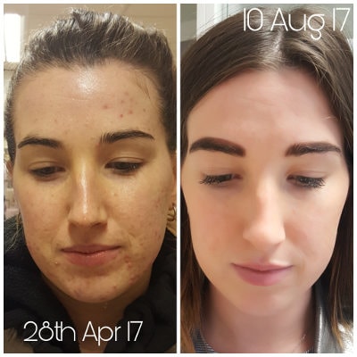 Skin Accumax Environ Jane Iredale Jane1 min