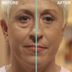 Remescar Eye Bags and Dark Circles 8ml